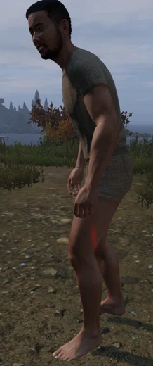 Кровотечение в DayZ